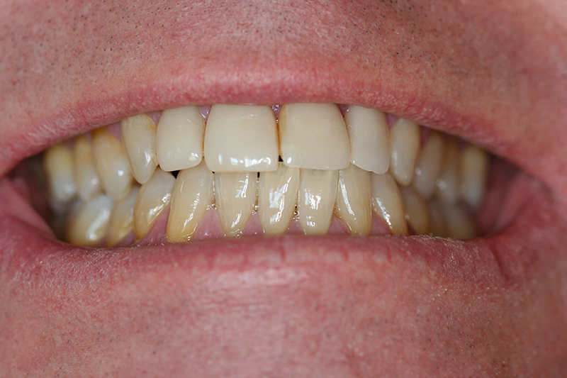 Case 1 – Before treatment