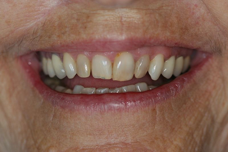 Case 3 – Before treatment