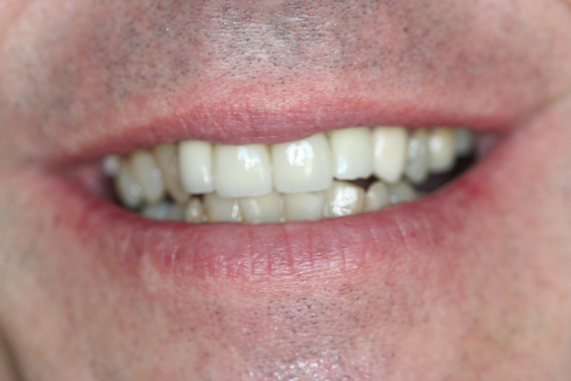 Case 5 – Before treatment