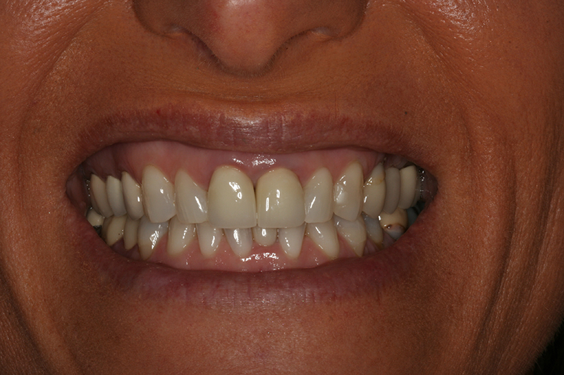 Case 6 – Before treatment