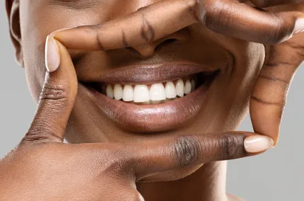 Clear Aligners